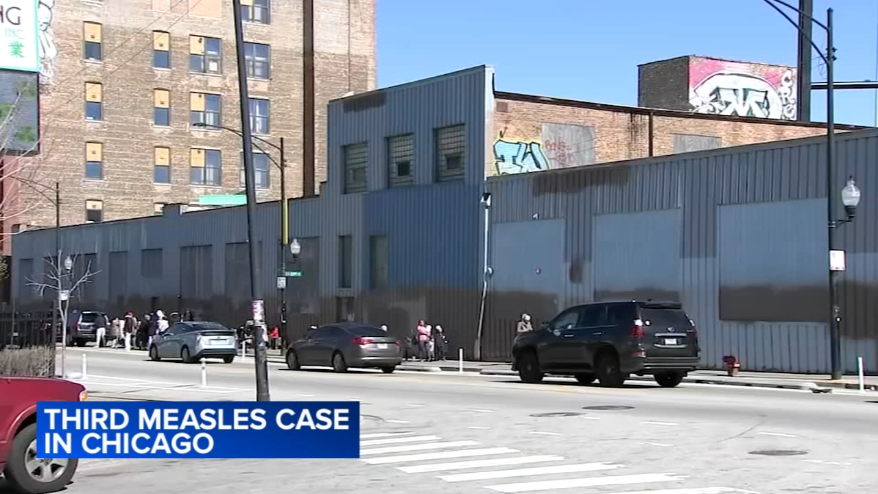 Migrant shelter child diagnosed with 3rd measles case is CPS student