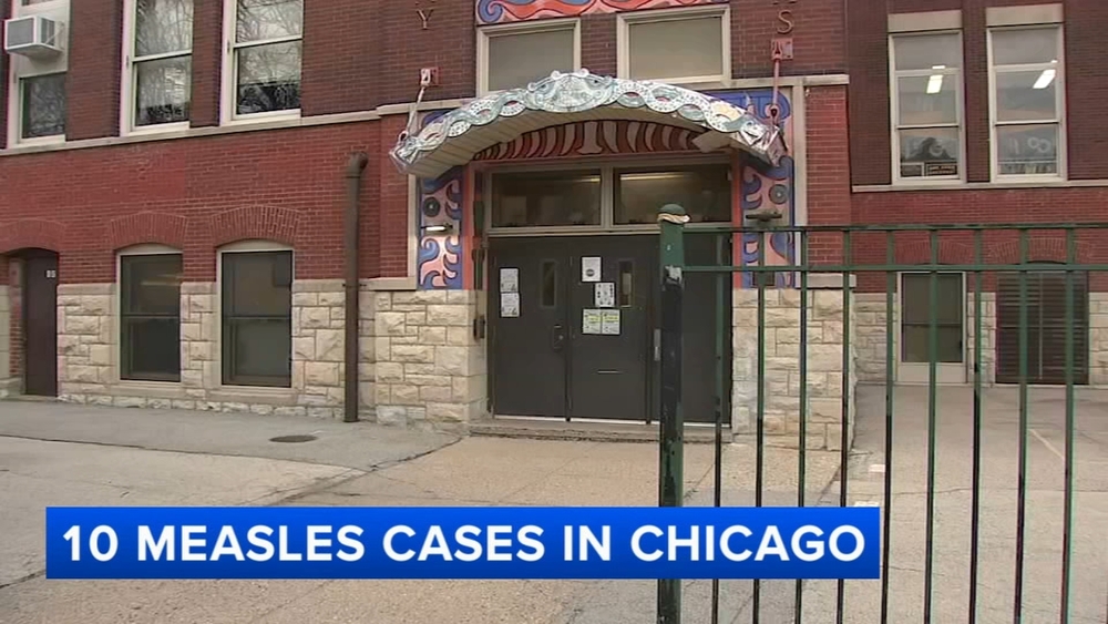 Some CPS parents concerned over measles cases