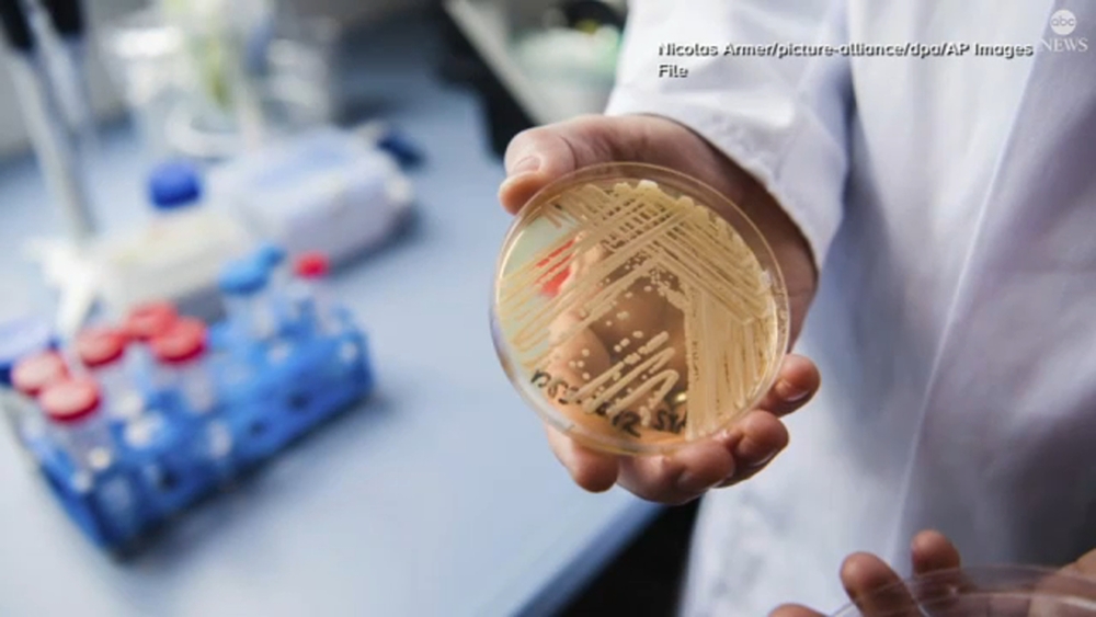 Rising fungal infections and what you need to know