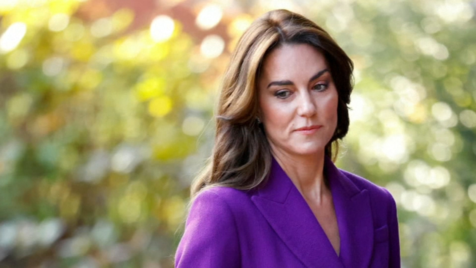 Princess Kate of Wales' diagnosis sparks conversation about rising ...