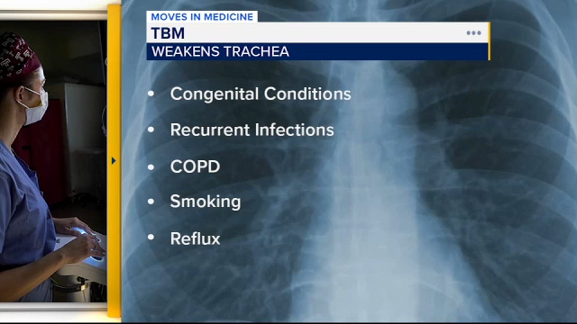 Exploring TBM, an underdiagnosed lung condition