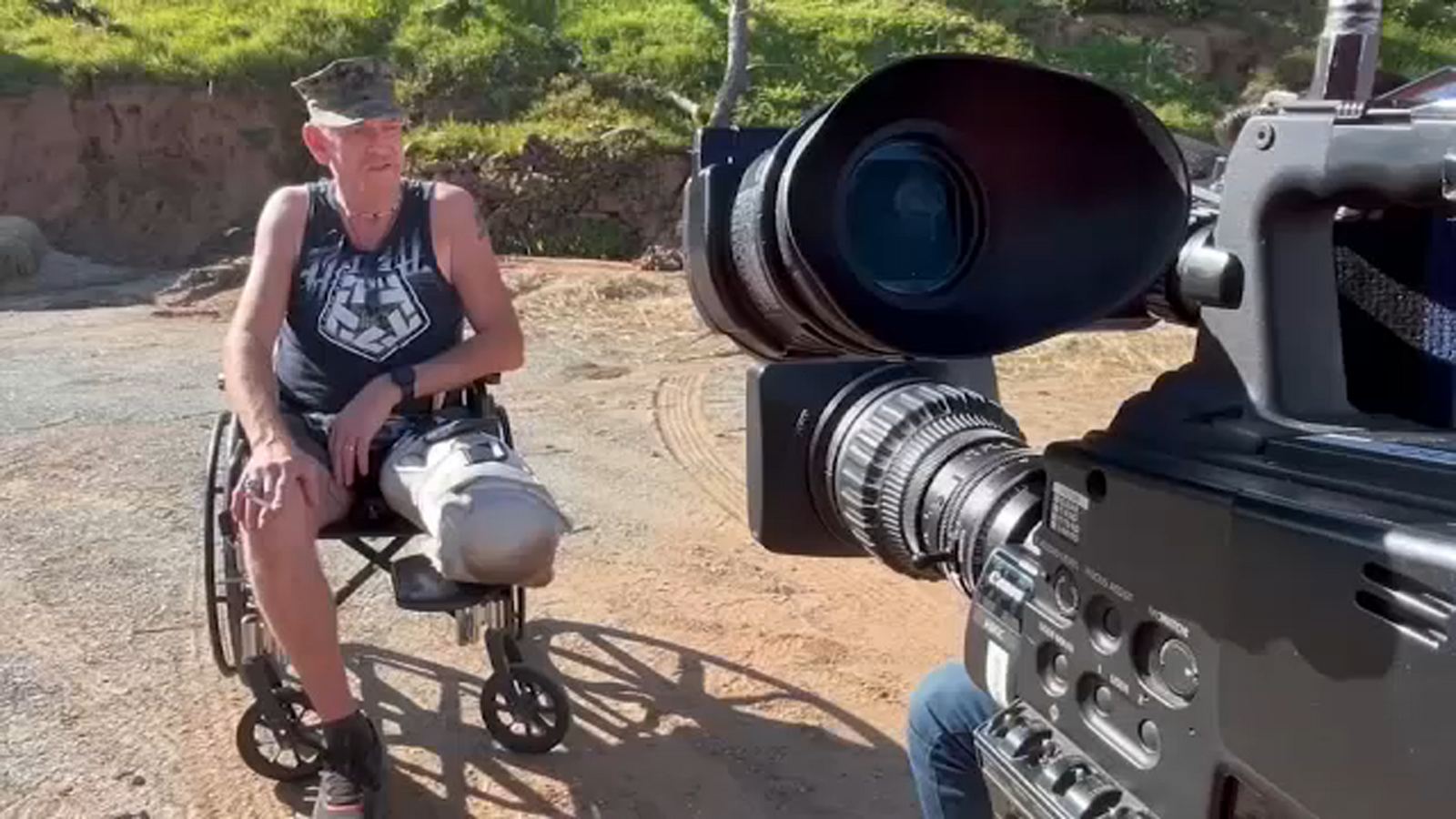 Oak Fire survivor faces new challenge after leg amputation