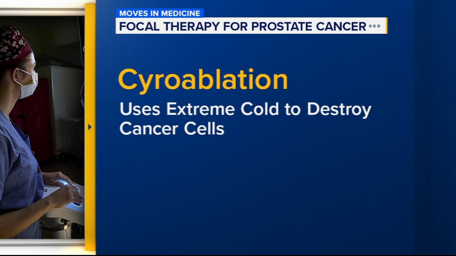 Focused therapy cuts side effects in treating prostate cancer