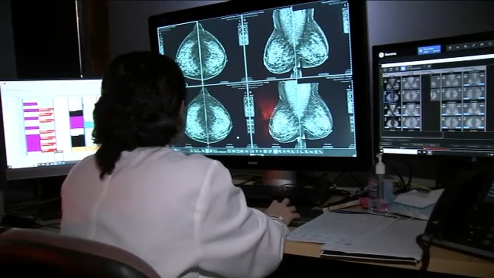 New breast cancer screening guidelines