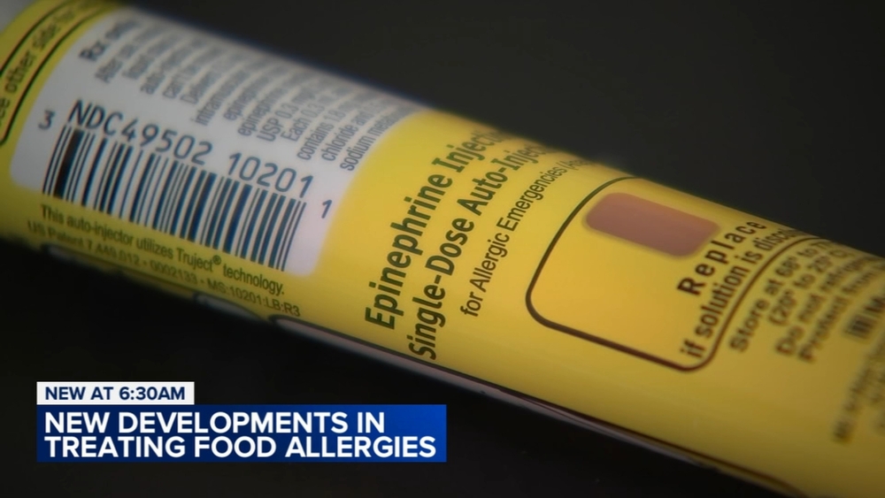NU doctor shares new  developments in treating food allergies