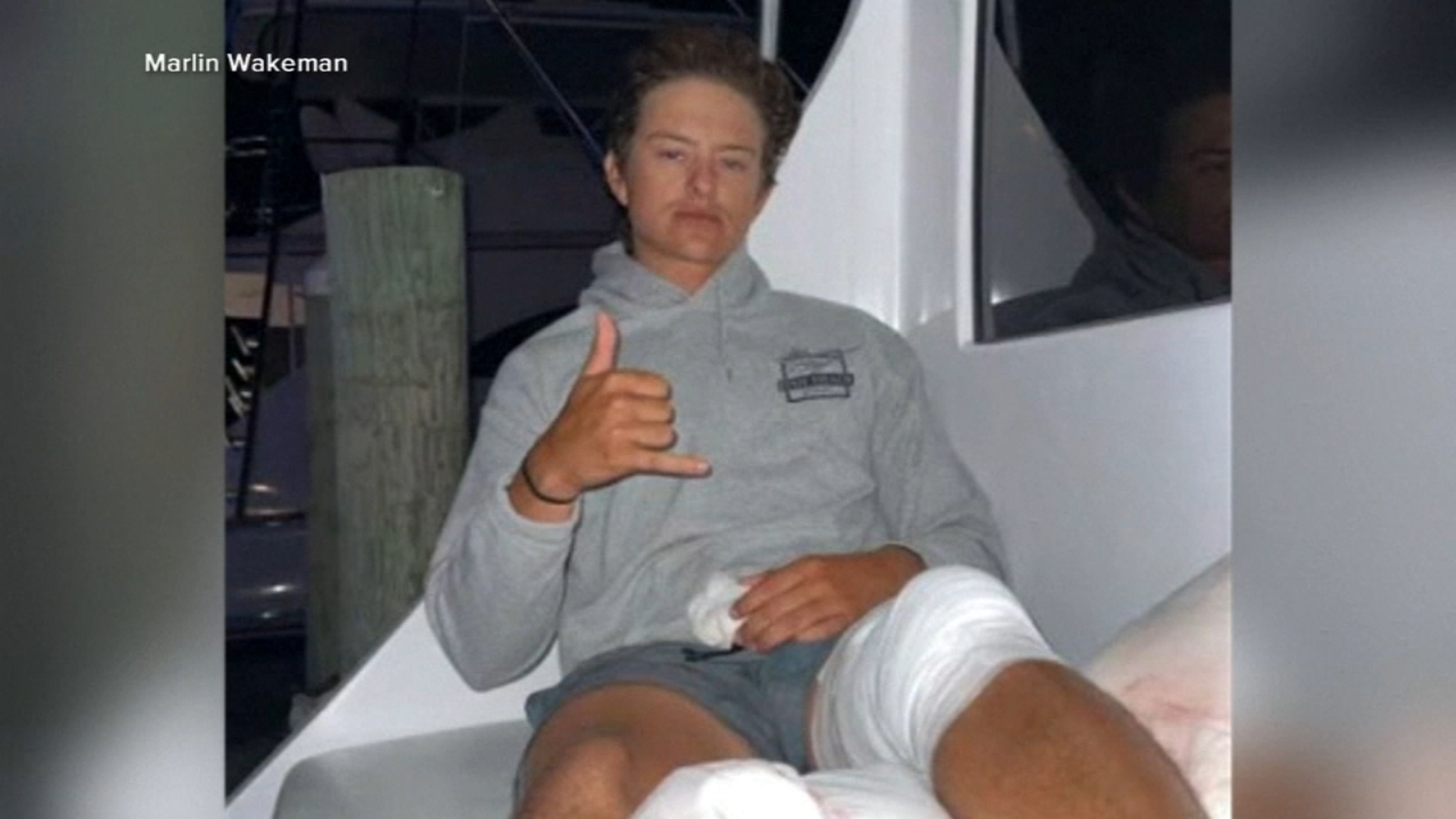 Florida man survives being bitten by sharks in ‘feeding frenzy’ after falling off boat in Bahamas