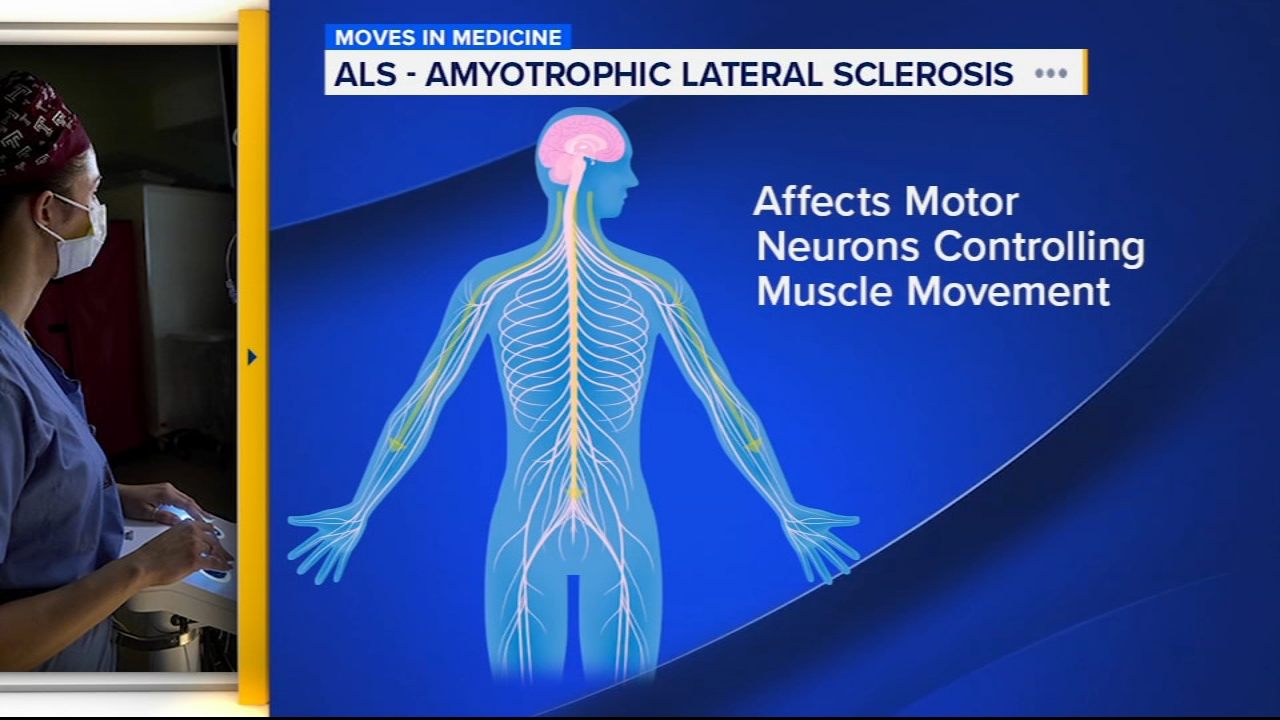 Temple Health team approach helps ALS patients live longer, healthier