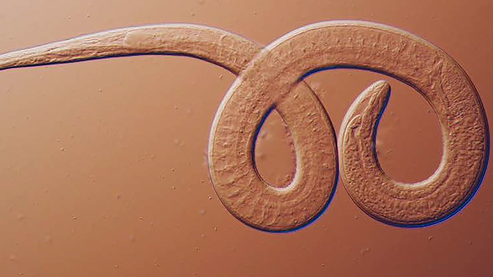 Family gets sick after eating black bear meat kebabs with parasitic worms