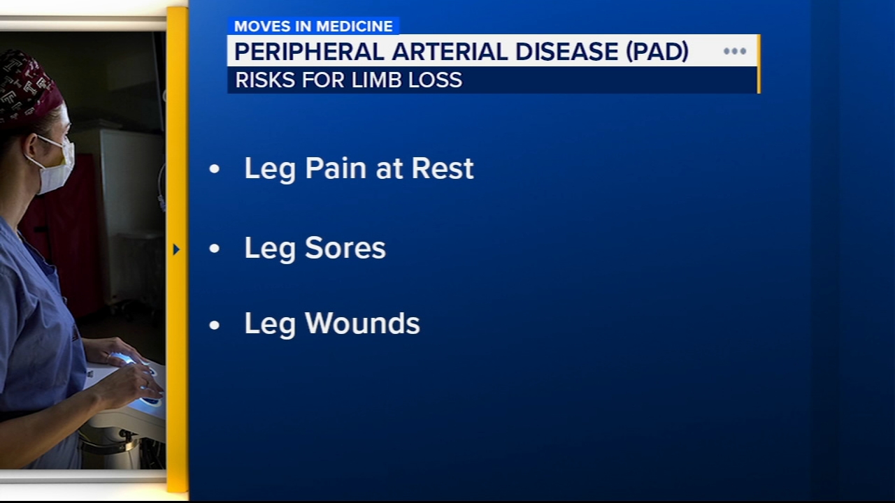 Leg cramps while walking could signal dangerous blockages in arteries 