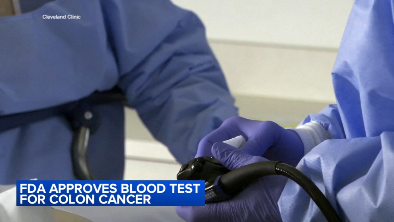Fda Colonoscopy Blood Test To Detect Colon Cancer Could Move A Step