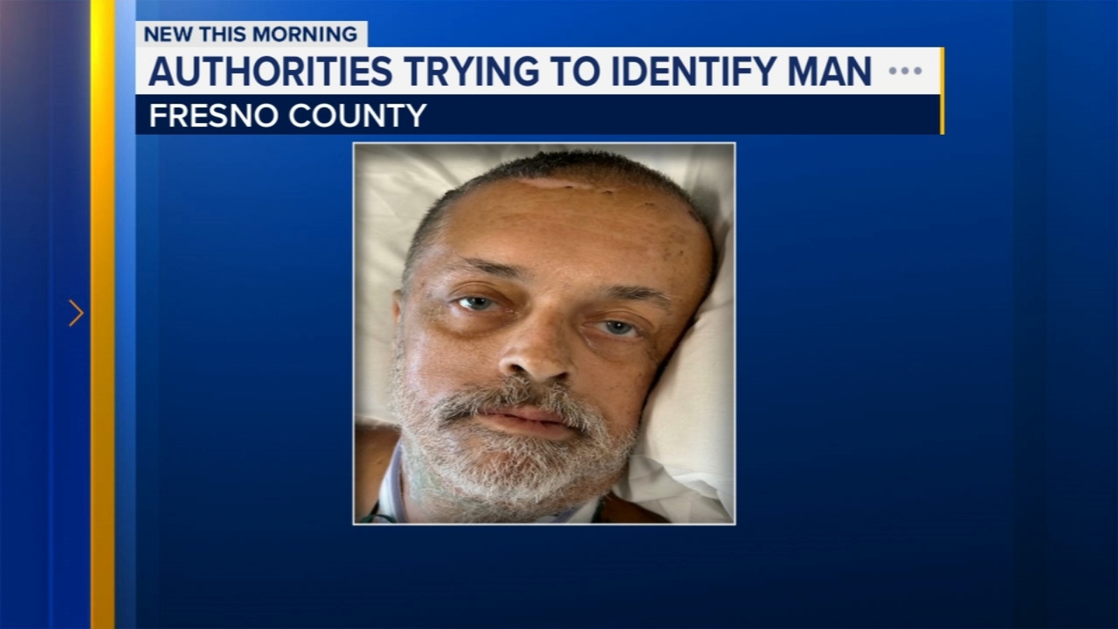 Authorities asking for help to identify man killed in Fresno