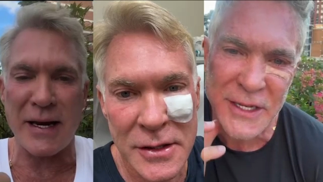 ABC News' Sam Champion shares his skin cancer treatment journey - ABC7  Chicago