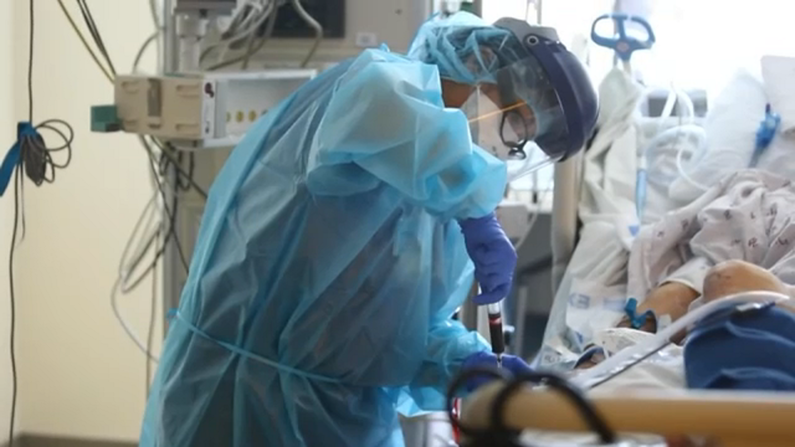 People infected with COVID19 early on show increased risk of heart