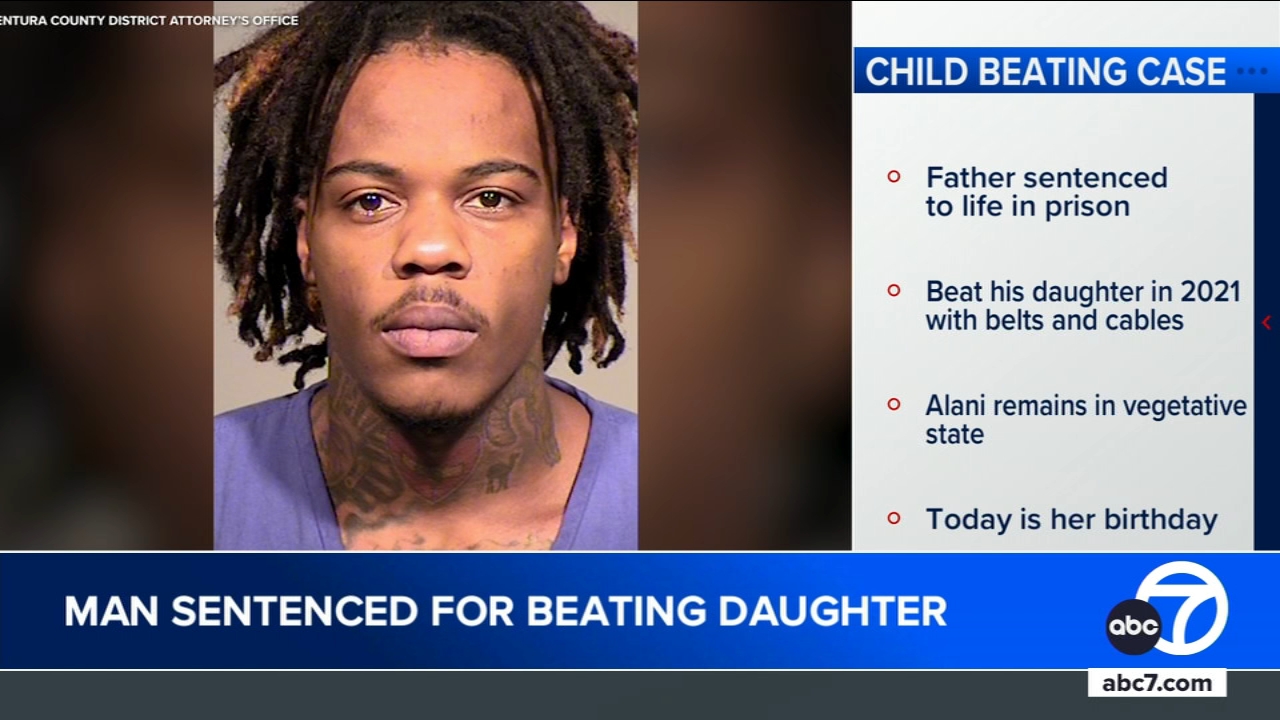 Thousand Oaks man sentenced to life for savage beating of daughter