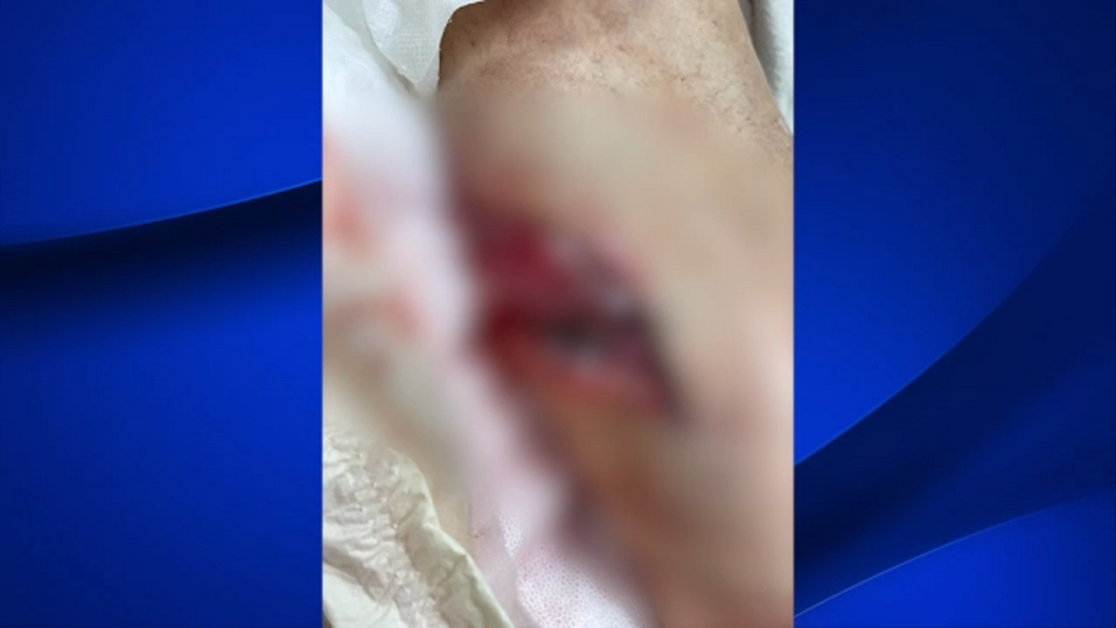 Family searches for answers after pit bulls attack elderly man in Fresno