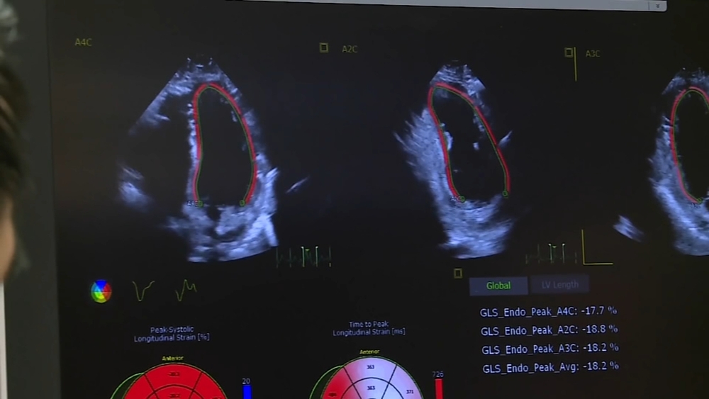NC hospital uses AI to help diagnose cardiac disease 