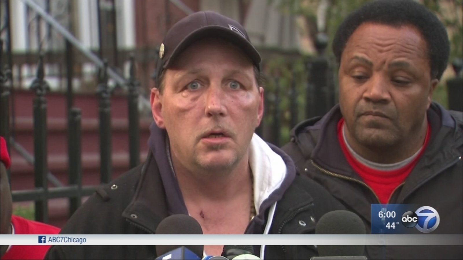 Man Beaten On West Side While Onlookers Yell Don T Vote For Trump Speaks Out Abc7 Chicago