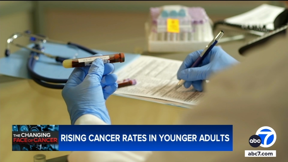 Cancer rates are rising in younger adults. Here's what to know