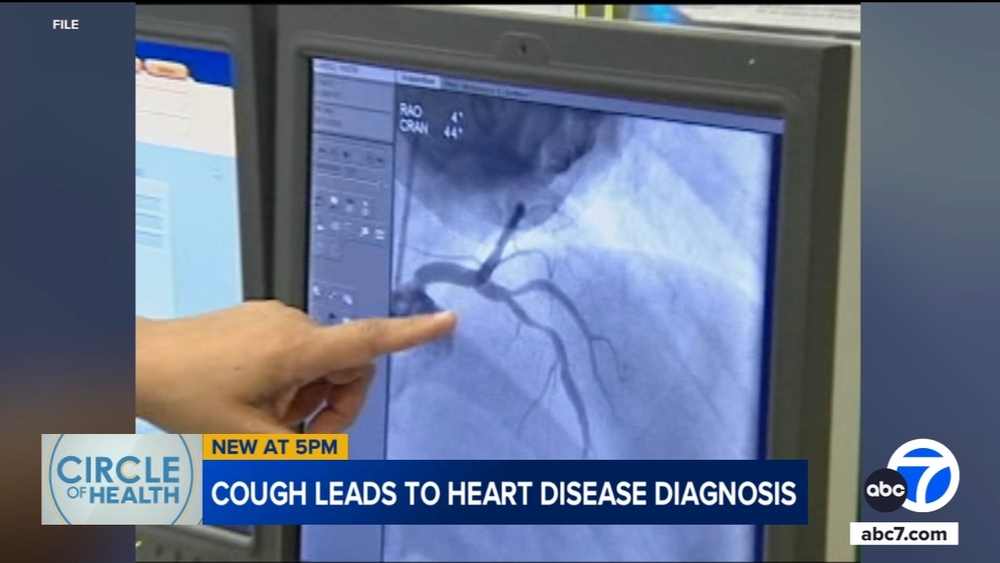 How a persistent cough led to a diagnosis of hidden heart trouble