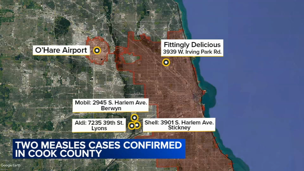 1st measles cases reported in Cook County this year