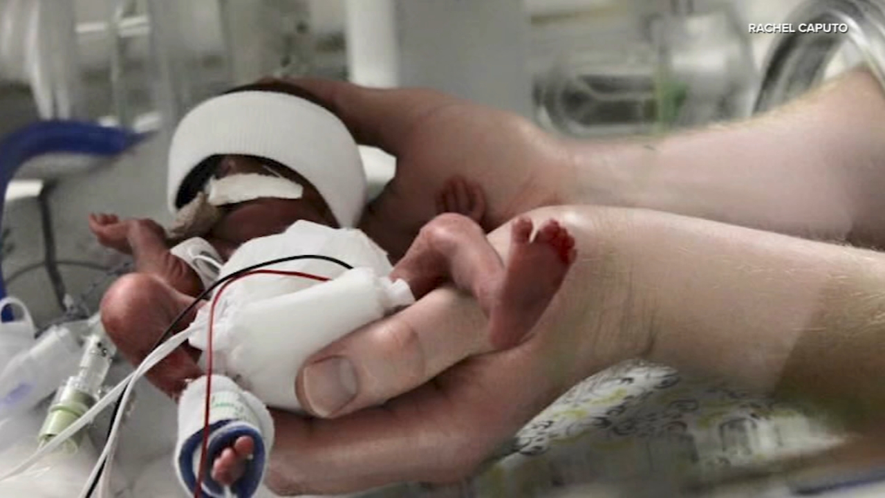 Rachel Caputo gave birth at 24 weeks to her baby girl London. Now, thanks to human donated milk, London is 9 years old.