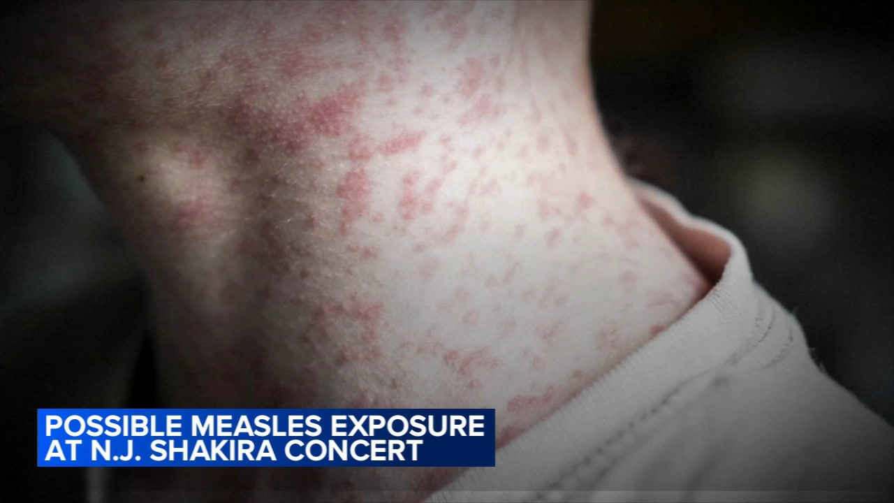 Officials alert possible measles exposure at Shakira's MetLife show