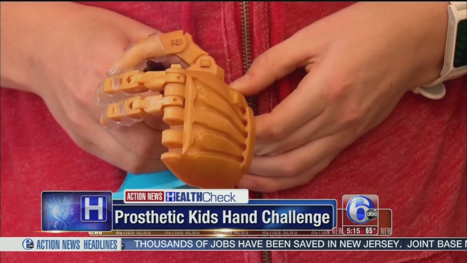 School classes making prosthetic hands for kids without them - 6abc