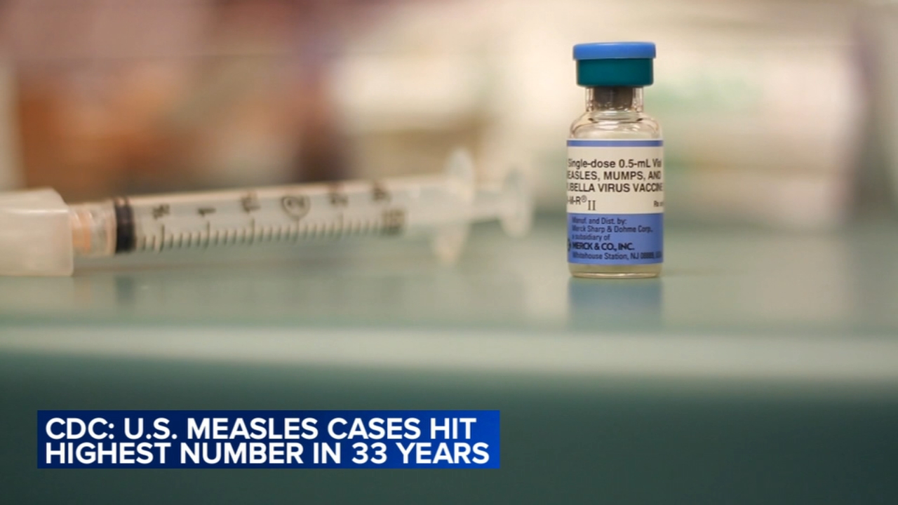 Measles case confirmed in traveler who passed through LAX, county health officials say – ABC7 Los Angeles