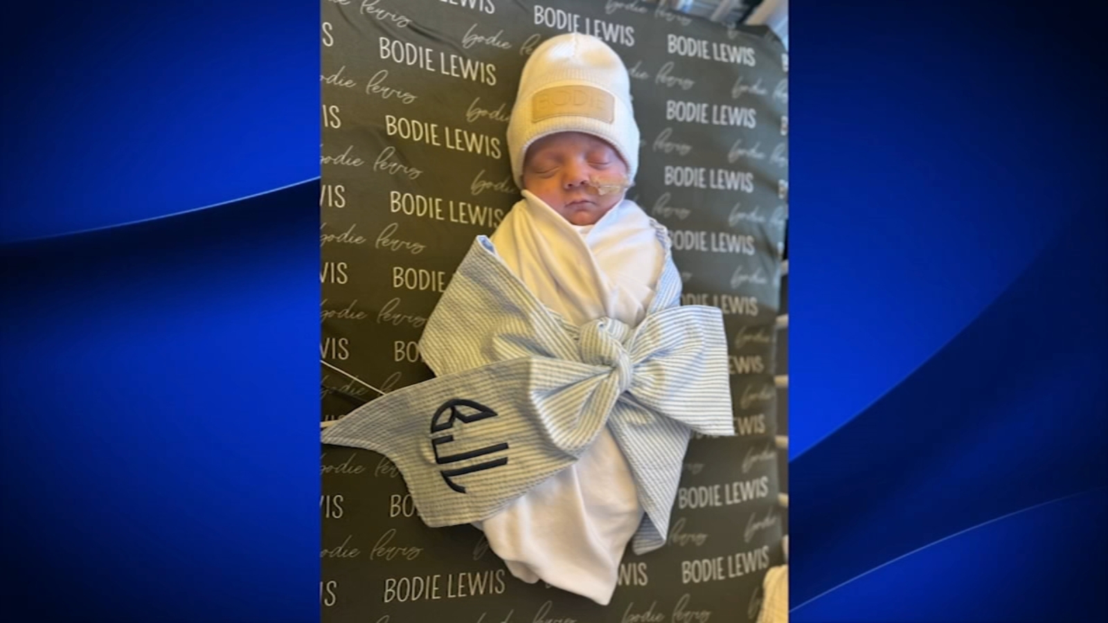 Fresno baby with rare seizure disorder passes away