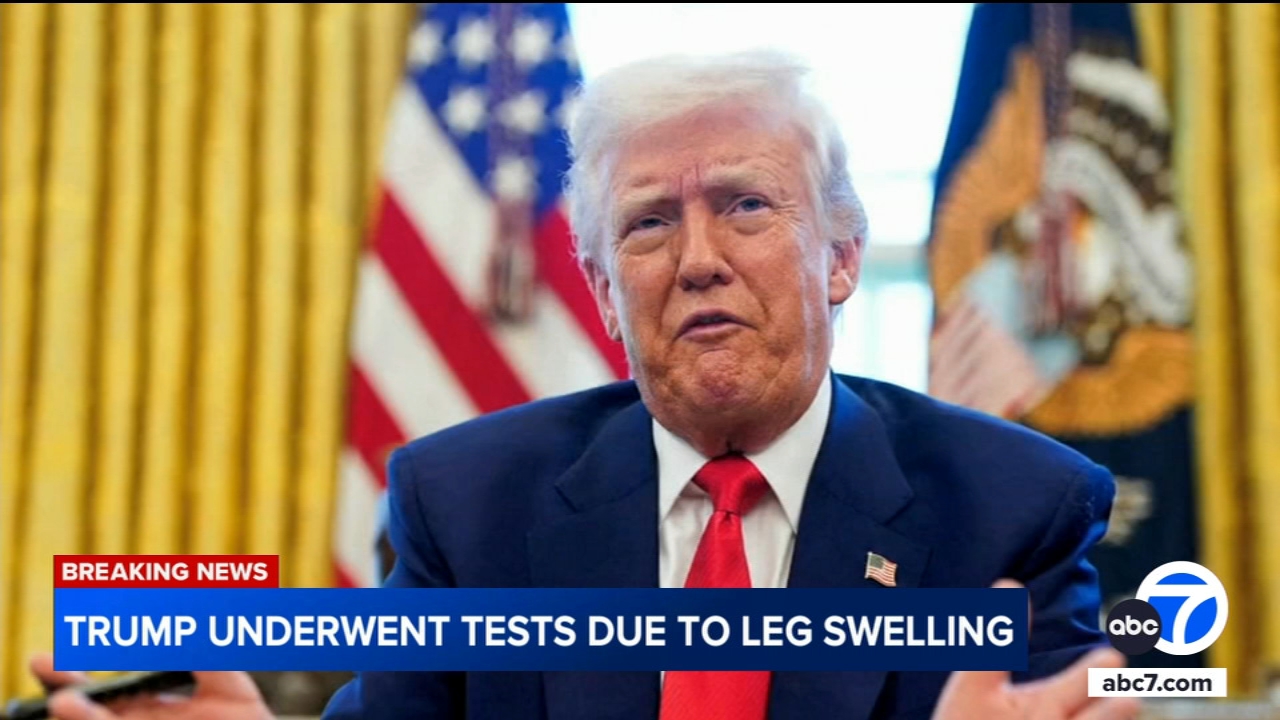 Trump underwent vascular testing because of leg swelling: White House