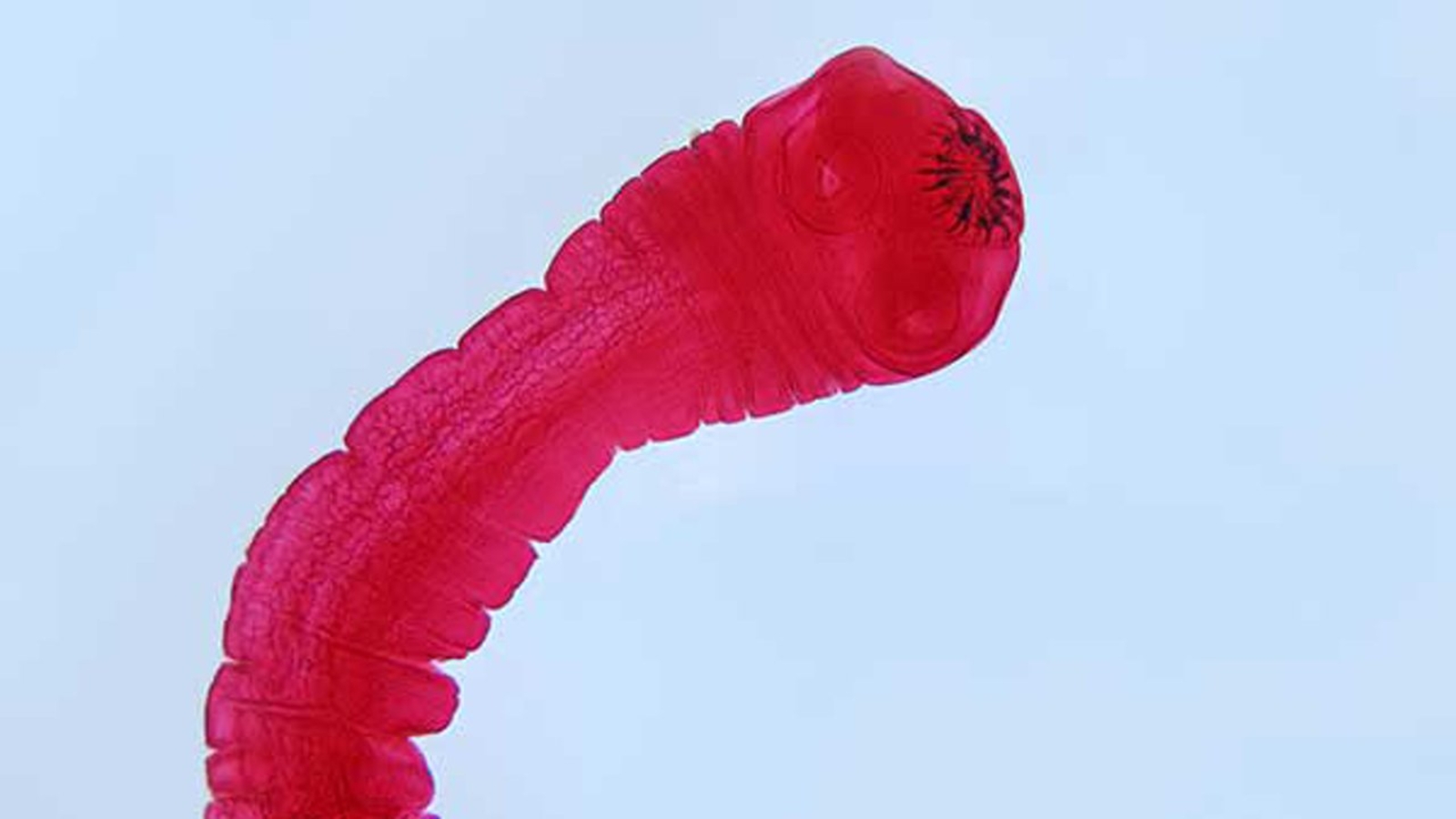 Doctors remove 6foot tapeworm through man's mouth ABC7 Chicago