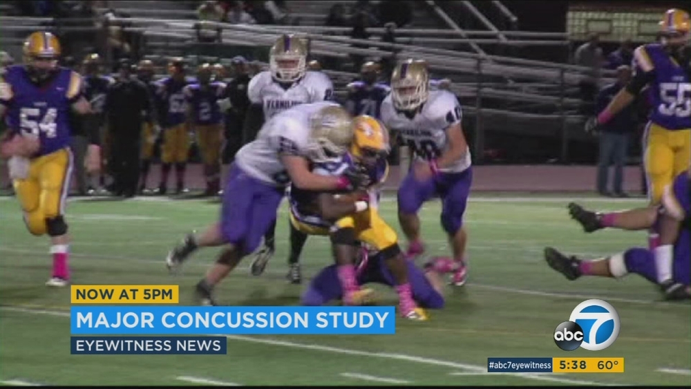 Many football concussions sustained in practice, study finds