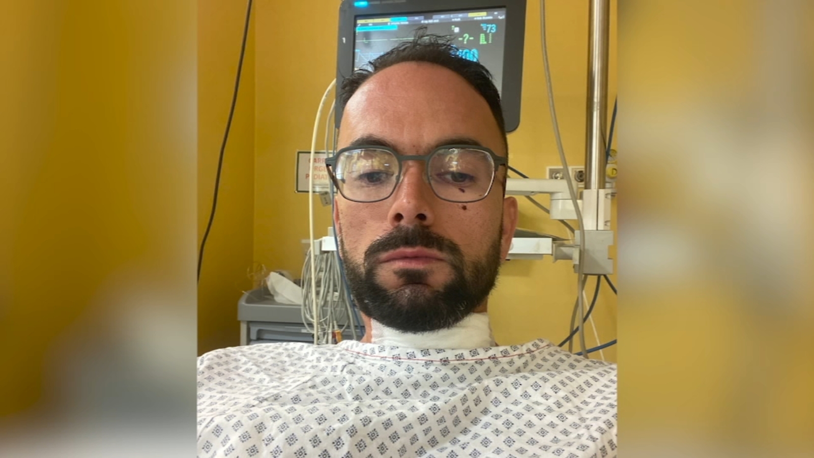 'It's a miracle': San Francisco teacher attacked in Italy returns to the US, recovering