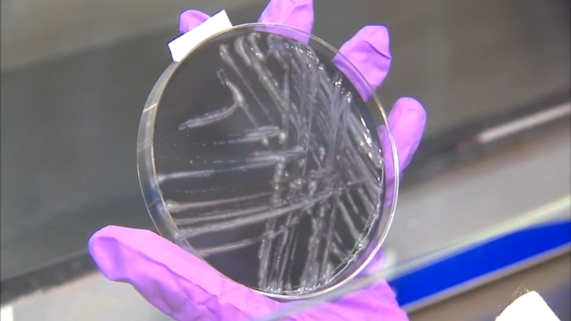 Legionnaires' outbreak with 5 cases in Central Harlem