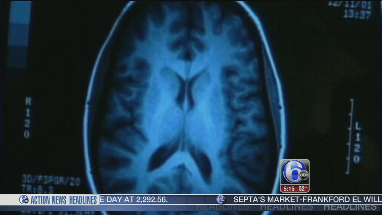 Parts of brain shrink during sleep