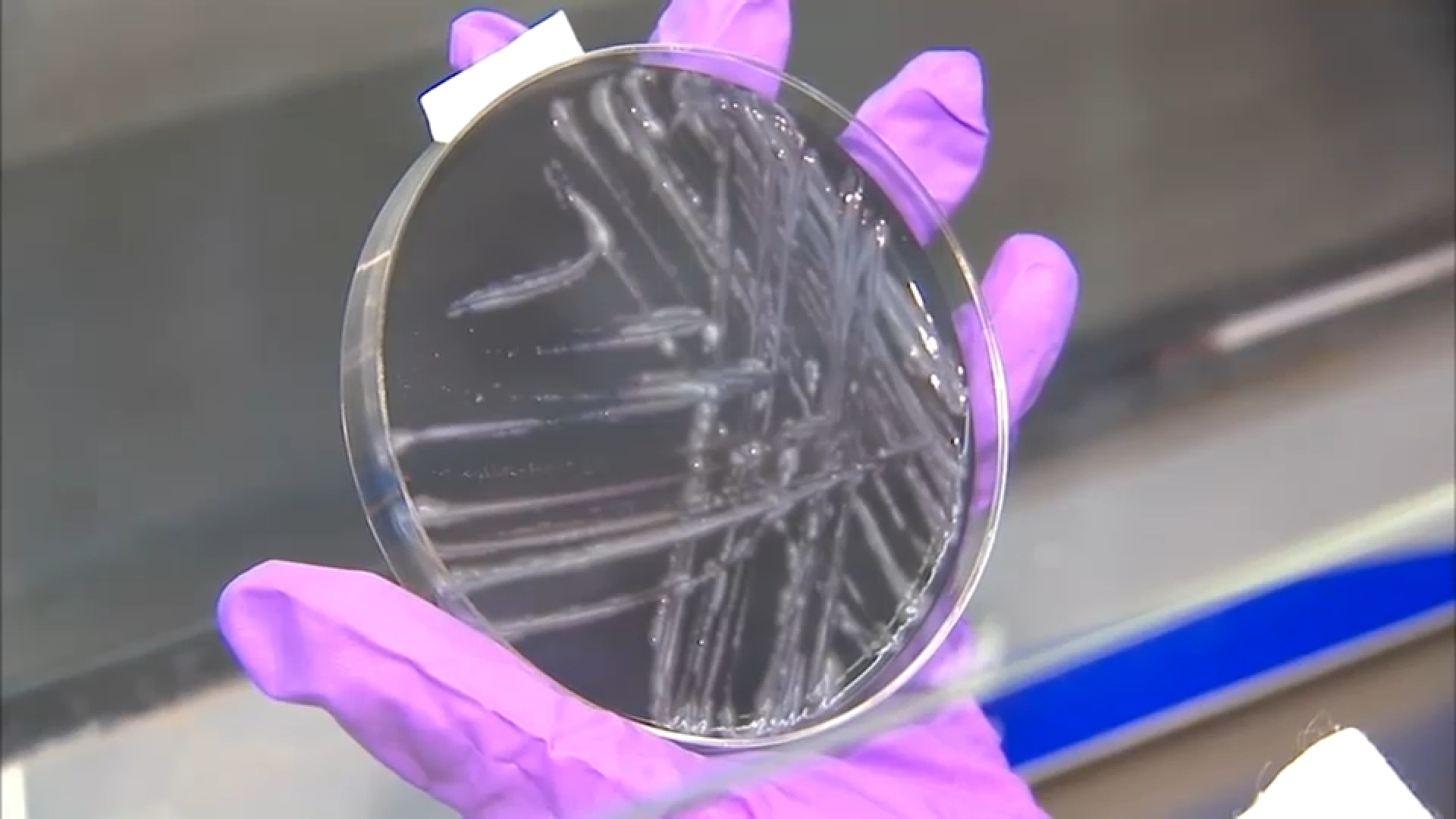 2 dead and at least 58 diagnosed with Legionnaires' in Harlem outbreak