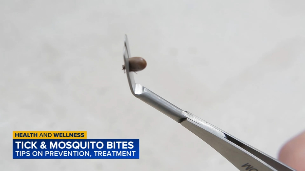 Tips to handle tick and mosquito season in Valley