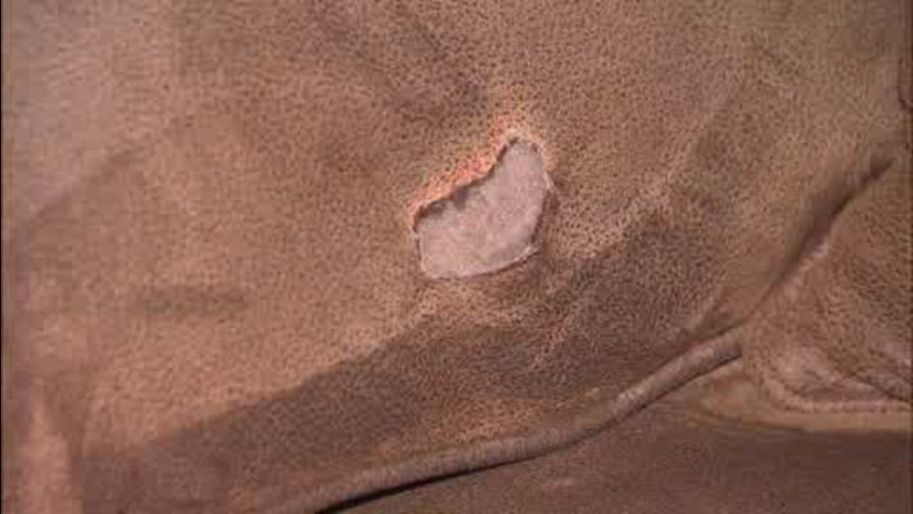 Man says phone injured him, burned sofa
