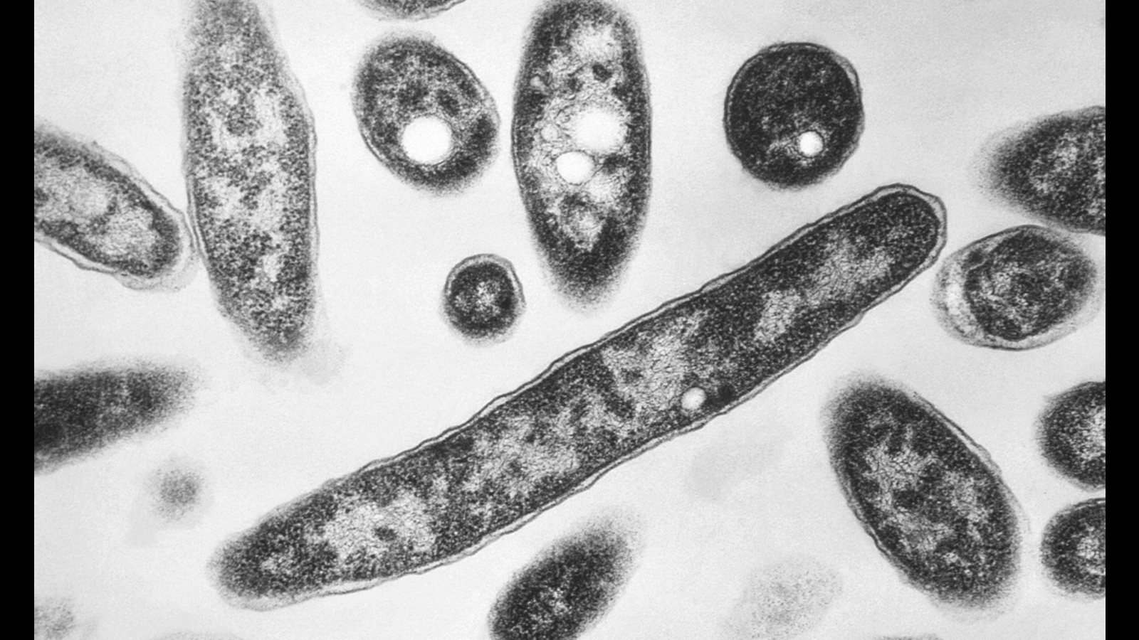 Health officials warn of rise in Legionnaires' disease cases in North Carolina
