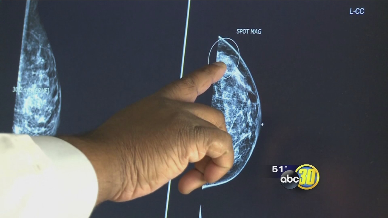 Young Women and Breast Cancer