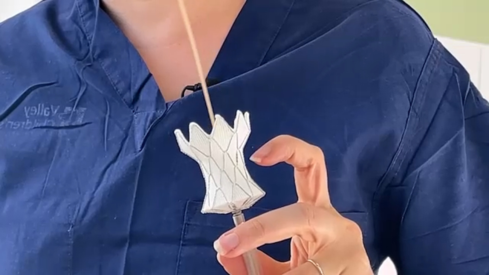 New technology at Valley Children's helping patients avoid open heart surgery