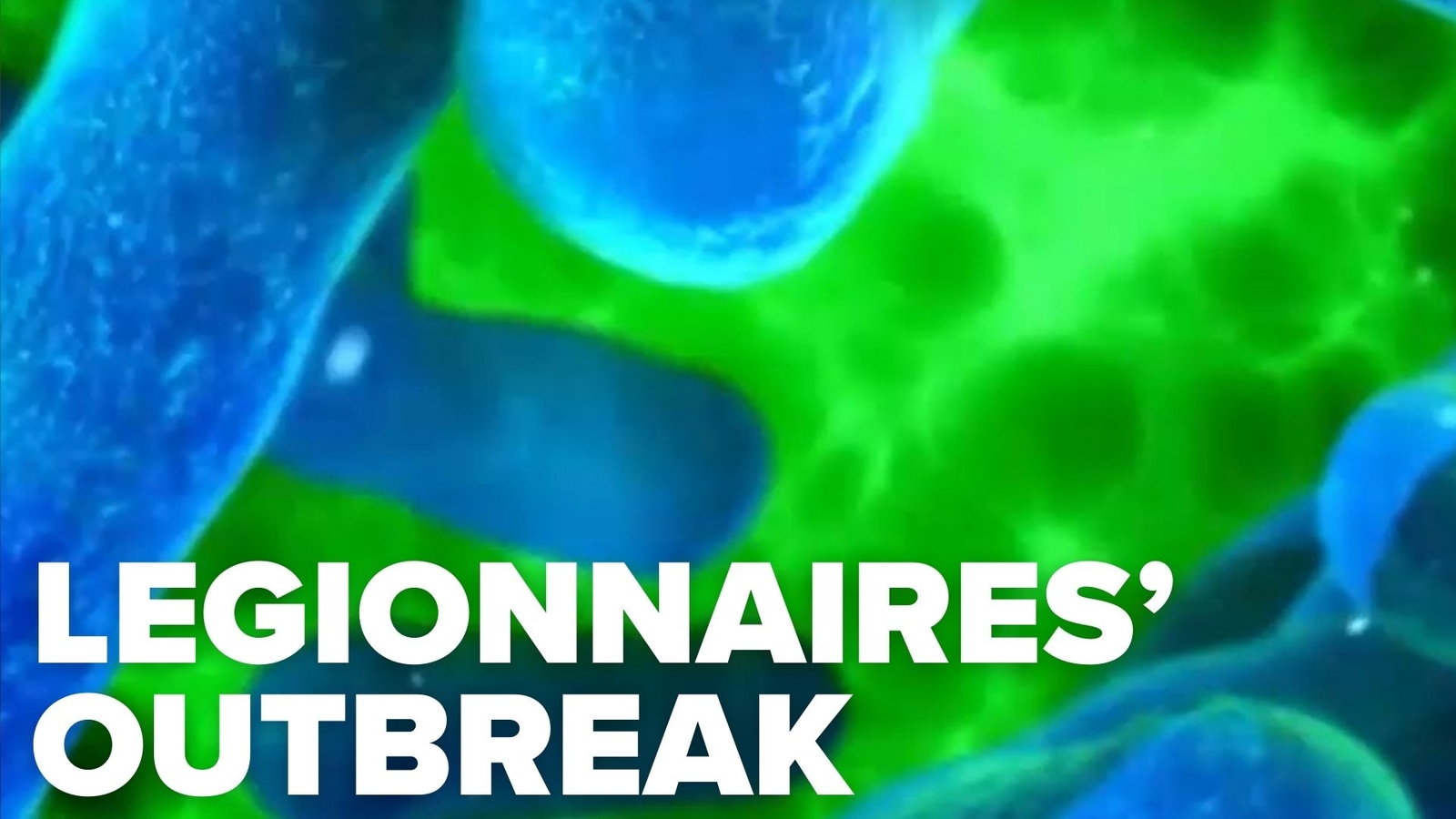 NYC identifies cooling towers tied to Legionnaires' outbreak, including Harlem Hospital | LIST