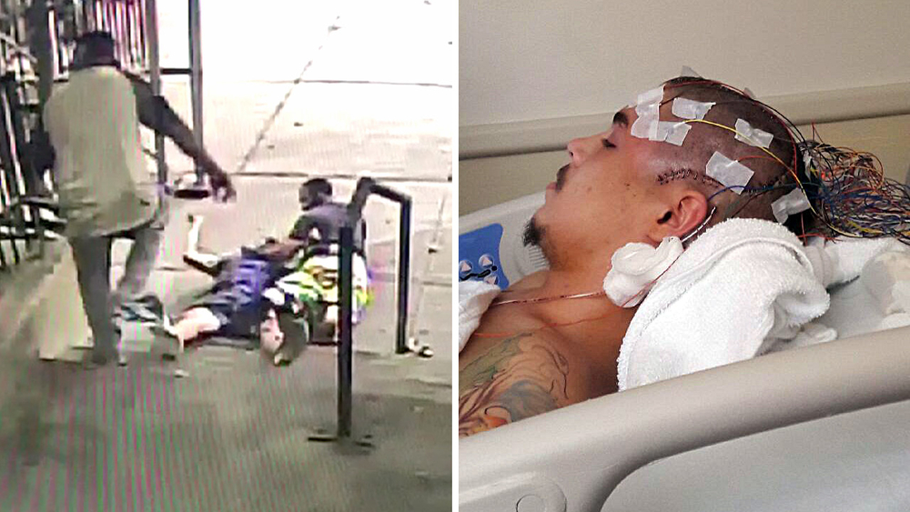 Man tackled NYPD says excessive force during arrest caused fractured skull