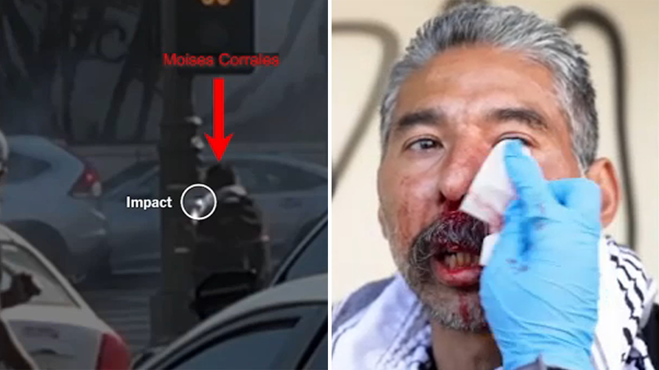 Video shows man injured by less-lethal projectile during DTLA protest