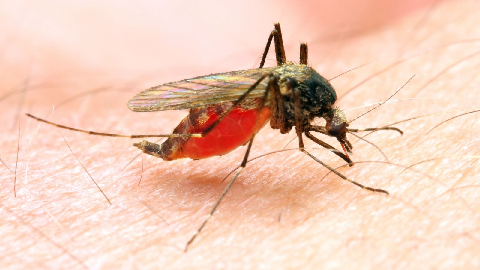New Jersey health officials investigate possible malaria case in Morris County