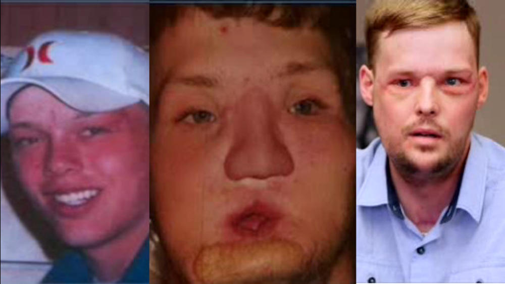 Twin tragedies give survivor a new face
