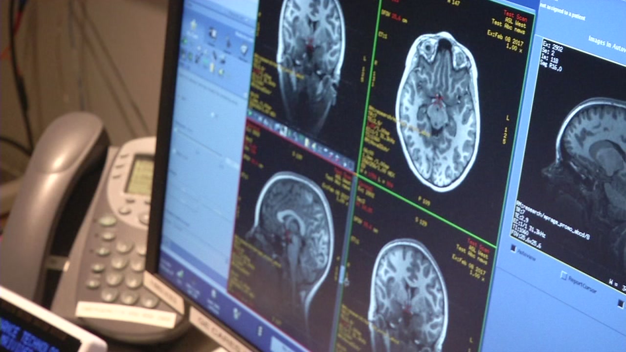 Bay Area researchers to probe teen brains