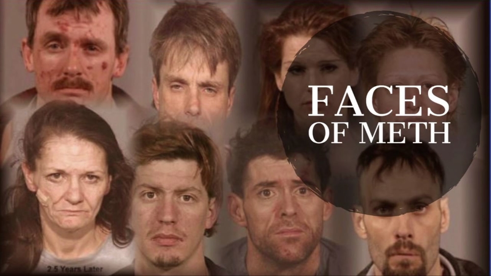 Before and after look at the effects of meth