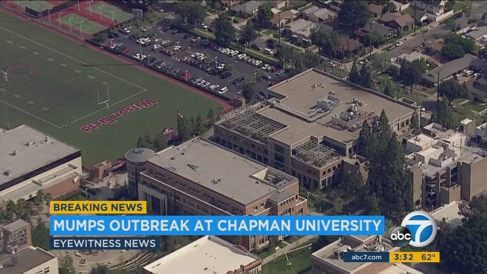 4 Chapman University students diagnosed with mumps