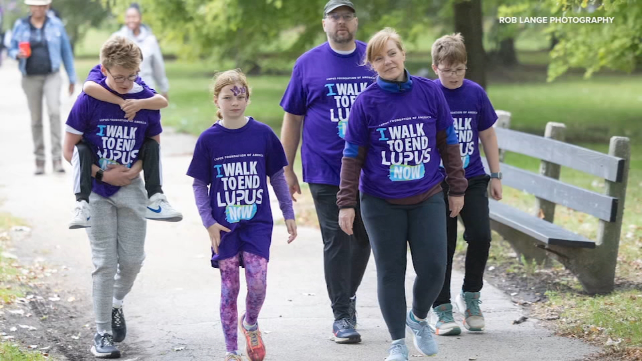 What is lupus? Hundreds to raise awareness of silent disease for